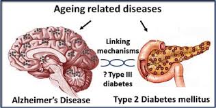 Image result for images Alzheimer's Disease and Type 2 Diabetes