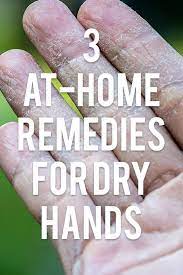 Dry Hand Remedies Natural Dry Skin Remedies At Home Dry Hand Remedies Dry Cracked Hands Dry Hands Remedy Dry Hand Skin
