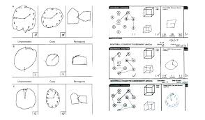 Image result for Mini-Cognitive Assessment Instrument