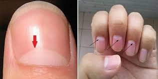 Do You Have White Spots Half Moon On Your Nails Here S What They Mean Moons On Fingernails White Spots On Nails Moon Nails