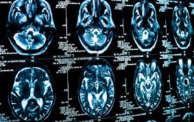 Radiologie pb is a network of six clinics offering a wide range of general and specialized medical imaging services. Radiologie Und Nuklearmedizin Klinikum Nordfriesland