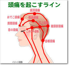ãé ­ç® ãã å¹æãã®ç»åæ¤ç´¢çµæ
