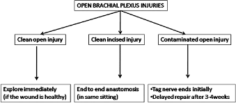 Adult Brachial Plexus Injuries Surgical Strategies And