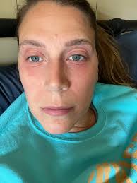 What safer medication/remedy can I use instead of this allergy medication?  I have severe inflammation