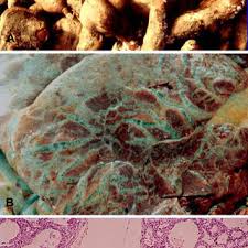 Dark brown sugar 1/2 cup (1 stick) butter 2 cups miniature marshmallows. Poisoning By Moldy Sweet Potatoes Ipomoea Batatas A Moldy Sweet Download Scientific Diagram
