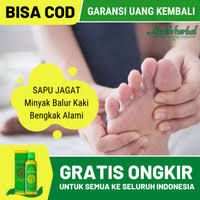 Jahe tidak hanya memiliki khasiat untuk menghangatkan tubuh saja akan tetapi jahe juga memiliki khasiat untuk dijadikan sebagai obat nyeri sendi. Jual Obat Untuk Kaki Keseleo Murah Harga Terbaru July 2021