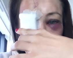 The fight spilled to the ground early, and from there penne went to work. Karolina Kowalkiewicz Oskarza Lekarza O Blad Zaoszczedzilby Mi Wiele Bolu