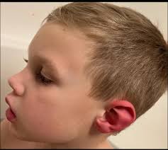 Anyone have a 1st grader with the inattentive type? She's very quiet but  fidgets with her hands and toes. We are having trouble getting a diagnosis  because at school she doesn't have