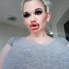 The middle english forms are from old english wiman, wimman, from wīfmann m (woman; Woman With Biggest Lips In World Shows Off Huge New Pout After 20th Injection Mirror Online
