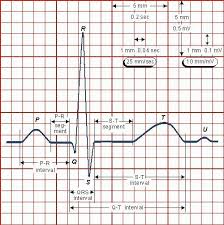 Ecg Reading An Ecg Printout Lets Focus On A Single