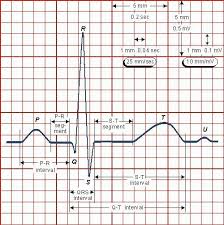 Ecg Reading An Ecg Printout Lets Focus On A Single