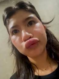 Für immer gelähmt?: Chase (27) beweist es allen! Er läuft wieder