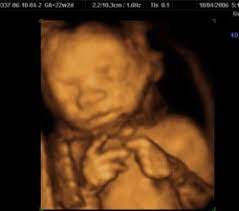 3d/4d ultrasounds sessions should be remembered as good memories for years. 3d Ultrasound Images In New York Ny Manhattan