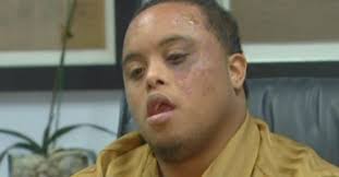 Down Sendromlu Bir Siyahi SUSKUN