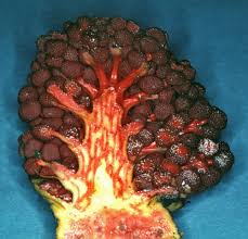 Image result for Sarcophyte