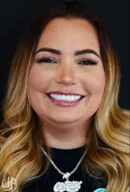 teeth #Veneersforteeth #veneers Looking for recommendations