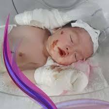Melanoma is the most serious form of skin cancer because it often spreads to other parts of the body. Skin Cancer No Baby Blisters