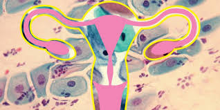 To conduct oneself in a usual or fitting manner under such conditions one could not be : Abnormal Pap Smear Results What That Really Means What Comes Next Self