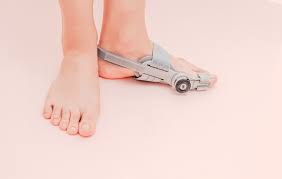 Image result for Foot Drop