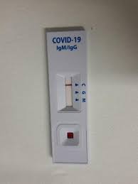 Ele îţi indică dacă ai sau nu anticorpi de covid în organism. Com Teste Em Farmacia Demorei 10 Minutos Para Descobrir Se Tive Covid 19 27 05 2020 Uol Universa