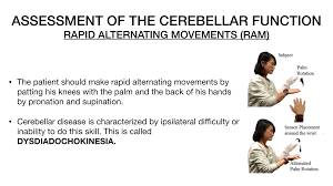 Image result for Rapid Alternating Movements