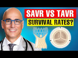 Surgical Versus Transcatheter Aortic Valve Replacement in Patients Over 65  Years Old