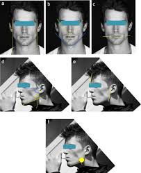 The desire for an enhanced jawline is now so commonplace that there are hundreds of articles and a huge number of youtube videos dedicated to the theme of 'how to get a better jawline'. The Ideal Male Jaw Angle An Internet Survey Sciencedirect