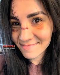 ♥️🔥 “Ya casi ni se nota”. Irene Aldana, tras 5 días de Noche UFC.