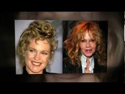 Melanie griffith with the help of plastic surgery couldn't become beautiful again like she was before in her youthful years. Melanie Griffith Plastic Surgery Youtube