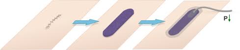 The therapy involves the controlled application of subatmospheric pressure to the local wound environment, using a sealed wound dressi. Closed Incision Negative Pressure Wound Management In Surgery Literature Review And Recommendations Springerlink
