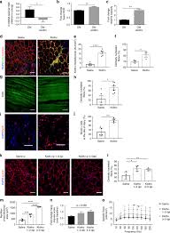 Learn vocabulary, terms and more with flashcards, games and only rub 193.34/month. Age Related Declines In A Klotho Drive Progenitor Cell Mitochondrial Dysfunction And Impaired Muscle Regeneration Nature Communications