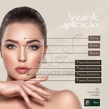 Harmonização Facial y Corporal