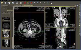 Maybe you would like to learn more about one of these? Top 25 Free Dicom Viewers For Doctors Medical Students And Health Professionals Postdicom