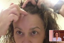 If we talk about female baldness, it doesn't need to always start from the front. Thinning Locks And Bald Patches The Hidden Horrors Of Female Hair Loss And How To Fix It Mirror Online