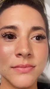 Lips augmentation 🫦 , 📍Grand Junction Co.| Bare Arsthetics & Hydration  Appointments Available. , ➡️ Schedule an appointment , ☎️ 970|314|9094,  💻baregj.com