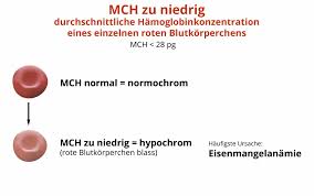 Mch Zu Niedrig