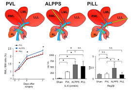 Das vorliegen eines pvl zu prüfen! Ijms Free Full Text Reg3a And Reg3b Expressions Followed By Jak2 Stat3 Activation Play A Pivotal Role In The Acceleration Of Liver Hypertrophy In A Rat Alpps Model Html