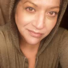 A little scratch in the shower. MCAS?