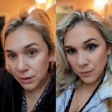 Mandy Kiss, before and after. #lifestyle