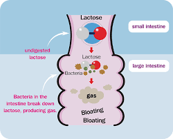 Image result for Lactase Deficiency