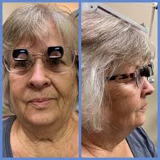 Low Vision of New Mexico