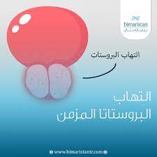 علاج التهاب البروستاتا المزمن نهائيا في تركيا - بيمارستان