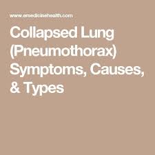 A pneumothorax can be caused by: Pin On Health Remedies