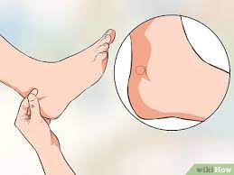 How To Use Acupressure To Induce Labour 11 Steps With Pictures