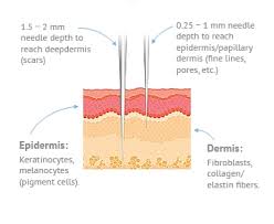 dermaroller micro needling