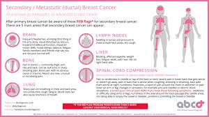 Hearing the doctor tell you that you've got cancer is undoubtedly one of the worst things you may experience. S2 Ep36 Breast Cancer Recurrence Signs Symptoms And Treatment My Breast My Health