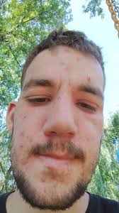 Hello ,I'm Tyler. I'm 22 years old. I'm very shy but I would love some new  friends who live in Texas! I'm looking for someone with similar interests,  like swimming and singing