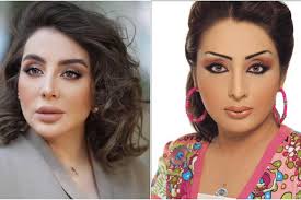 امل العوضي واطلالاتها قبل وبعد عمليات التجميل. Ø£Ù…Ù„ Ø§Ù„Ø¹ÙˆØ¶ÙŠ Ù…Ø¬Ù„Ø© Ø§Ù„Ø¬Ù…ÙŠÙ„Ø©