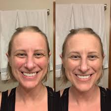 Transitioning to transmog