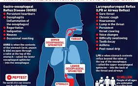We would love to hear your success stories in the comments section below! What Is Gastro Oesophageal Reflux Disease Peptest Blog